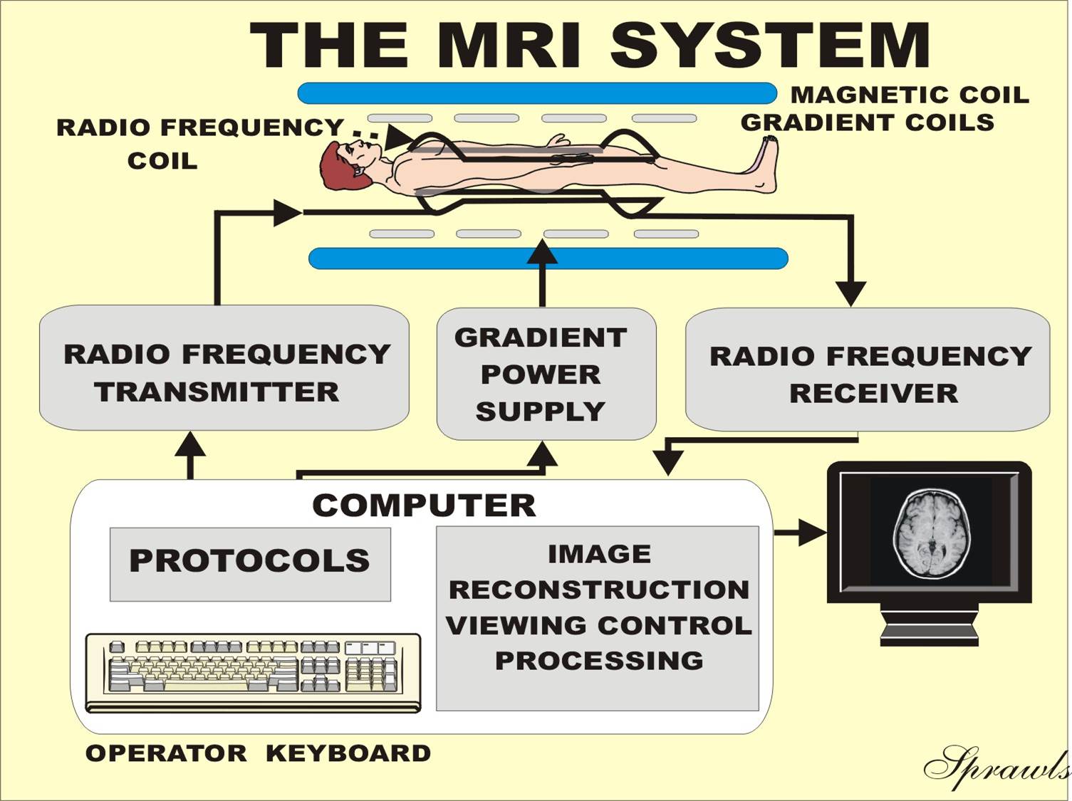 RF Coils for MRI